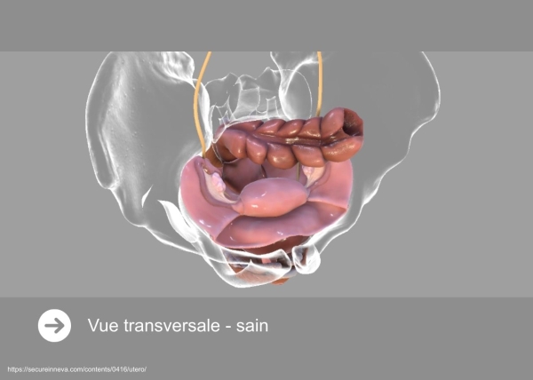 Définitions, localisation et épidémiologie